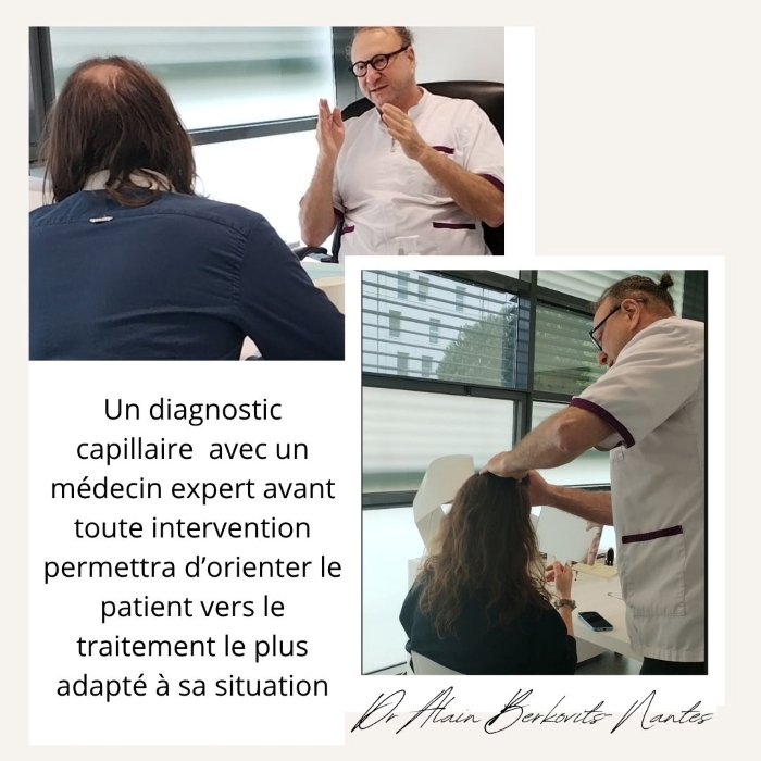 Greffe de cheveux ratée et reconstruction capillaire Nantes- Dr Berkovits
