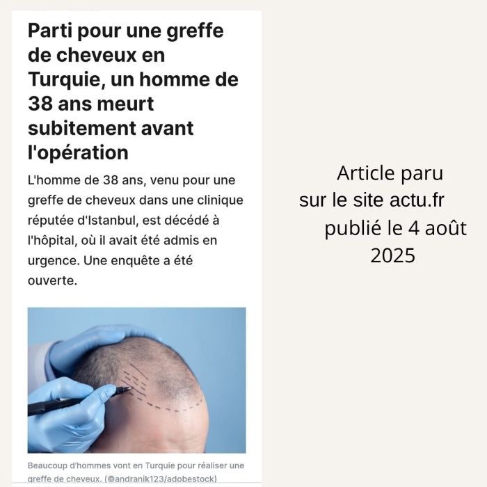 Les risques d'une greffe de cheveux en Turquie