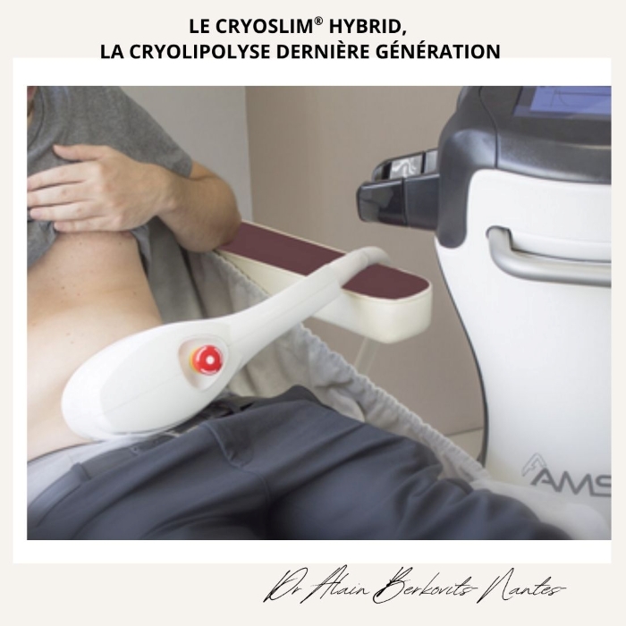 cryolipolyse Nantes