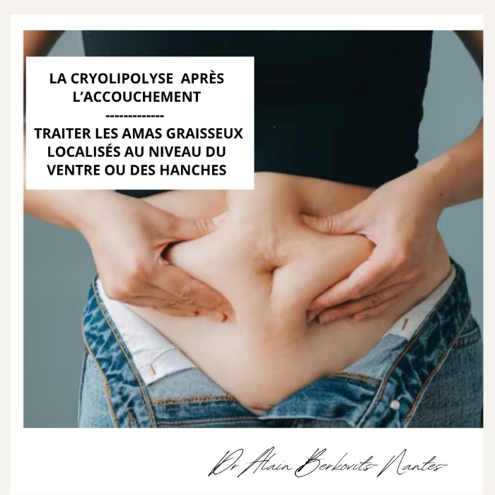 La cryolipolyse après l'accouchement